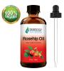 Skinology Rosehip Oil - 100% Pure Cold Pressed Certified Organic Virgin Rose Hip Seed Oil